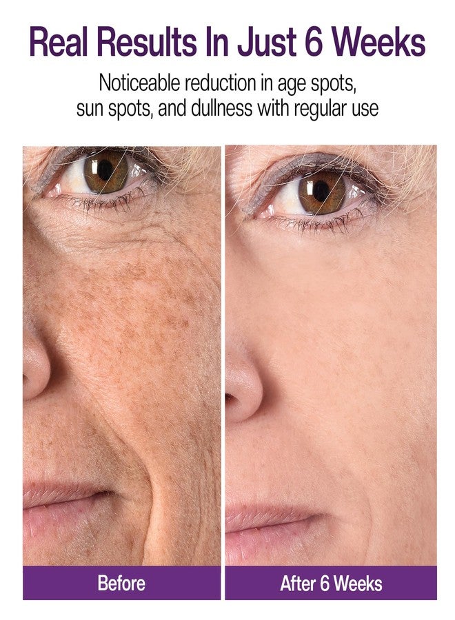 Jtopyrt Dark Spot Cream, Brightening Treatment Diminishes Age Spots, Sun-Damage, Liver Spots, Freckles & Discoloration For Younger Looking Skin - Fader & Corrector For Face, Chest, Hands & Body - Image 3